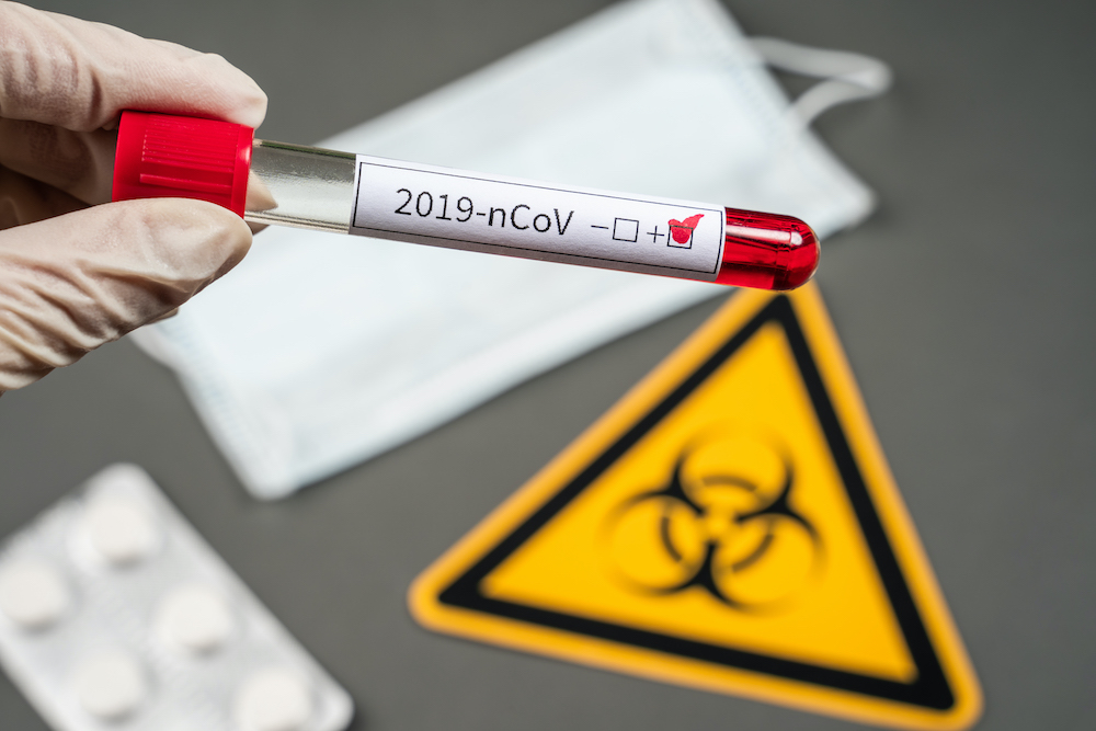 Blood test tube in doctor hand, Mers-CoV Coronavirus test label in hospital blood test tube for analysis. 2019-nCoV virus infection originating in Wuhan, China