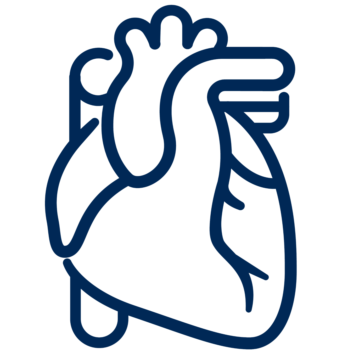 Coronary Revascularization