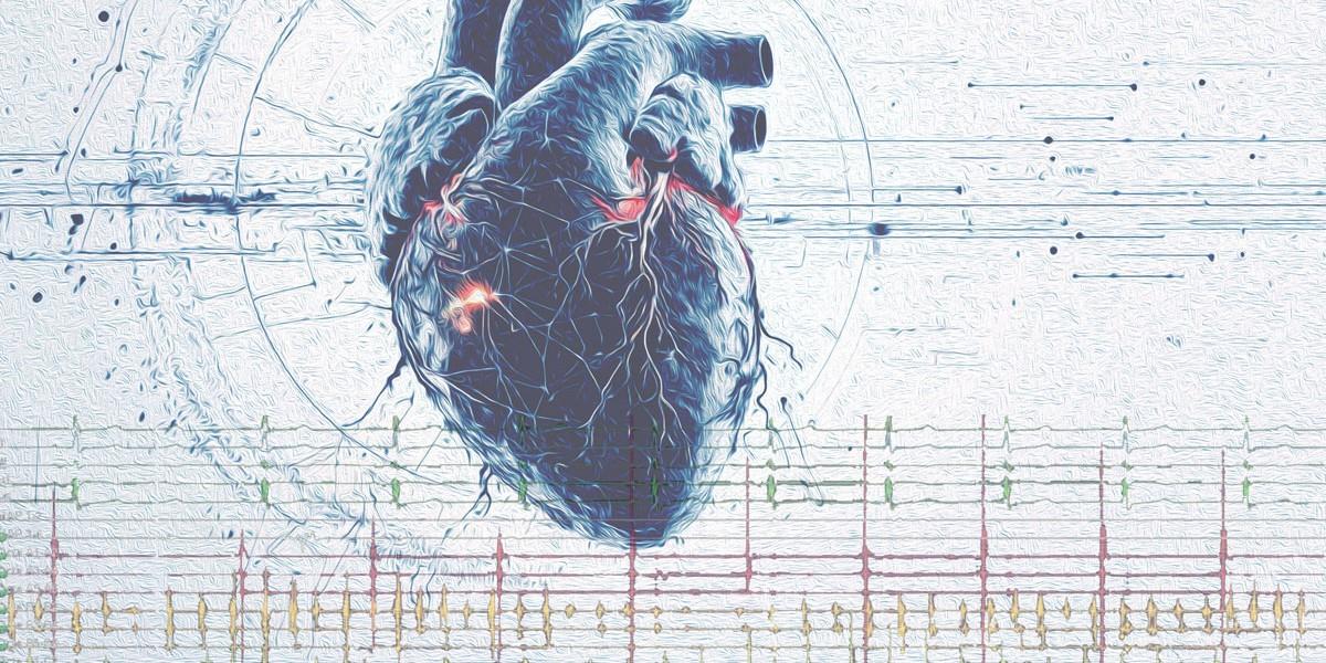 Cardiac electophysiology program banner