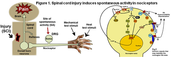 Picture of spontaneous activity in nociceptors