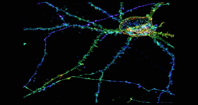 Picture of Hippocampal neuron Nikon SIM.