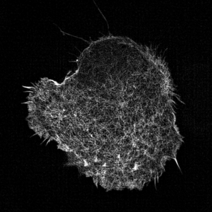 Movie of leukocyte actin cytoskeleton.
