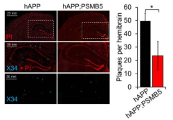 Proteasome function in Alzheimer's disease