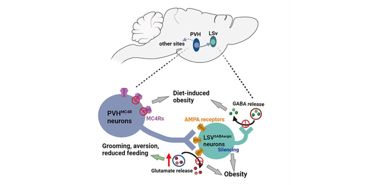 Schematic representation of diet-induced obesity.