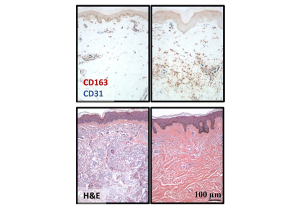 Scleroderma Imagery