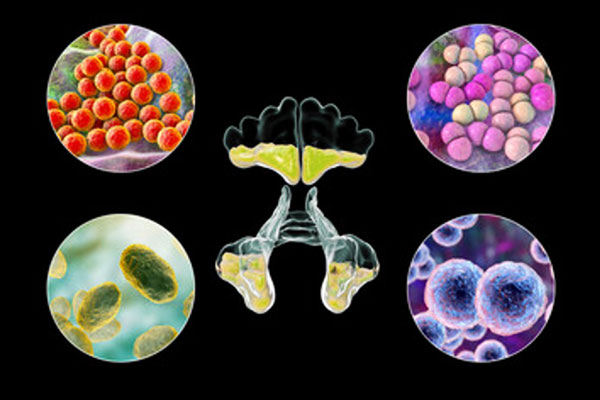 CRS & Microbiome