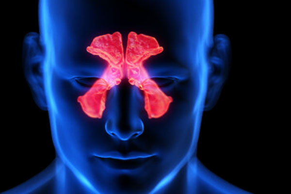 Chronic Rhinosinusitis