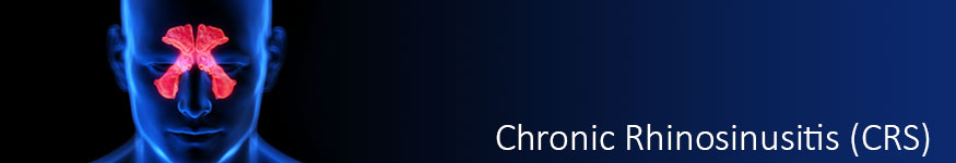 chronic rhinosinusitis (CRS)