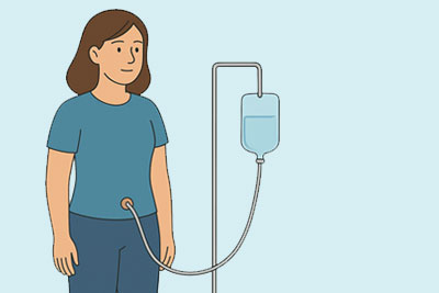 Illustration of woman getting dialysis