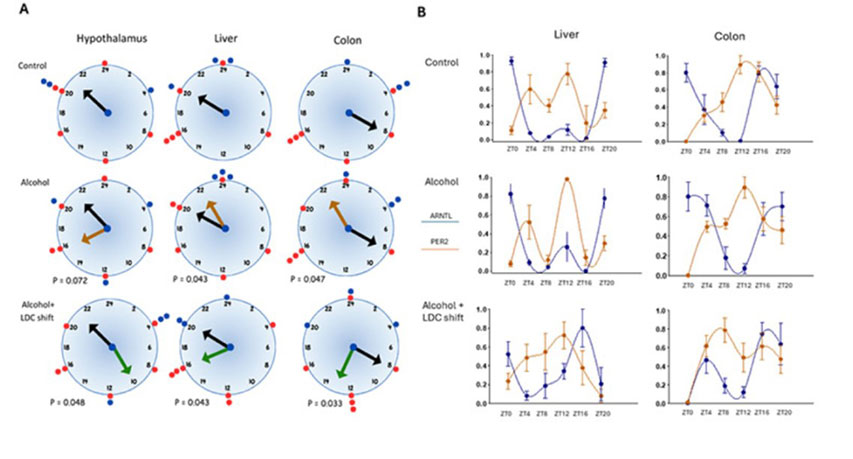 Chronobiology in Lifestyle, Gut, & Organ Damage