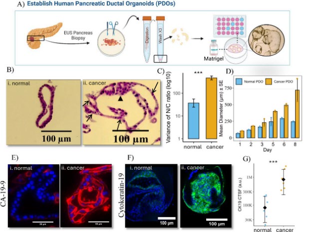 A Patient-Derived Organ-on-Chip Platform for Modeling the Tumor Microenvironment and Drug Responses in Pancreatic Cancer