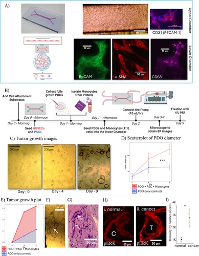 A Patient-Derived Organ-on-Chip Platform for Modeling the Tumor Microenvironment and Drug Responses in Pancreatic Cancer