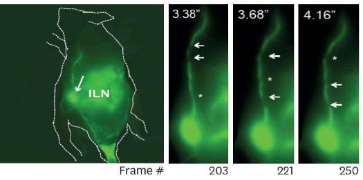 Complement Anaphylatoxin C5a-Induced Mouse Lymphatic Functions Modulate Interactions Between Endothelial Cells and T Lymphocytes.
