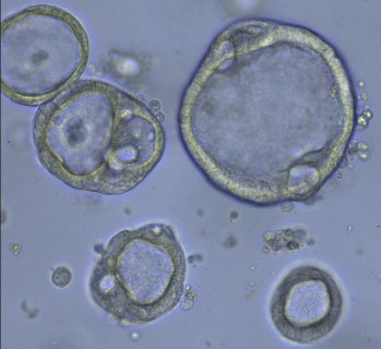 A tumour-derived organoid biobank maps cancer gene dependencies