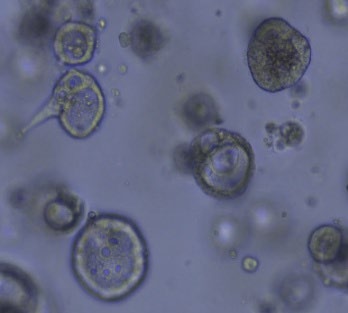 A tumour-derived organoid biobank maps cancer gene dependencies