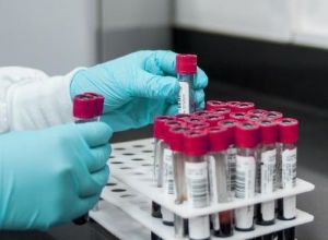 test tubes in holder