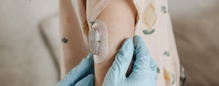 Continuous Glucose Monitoring Device