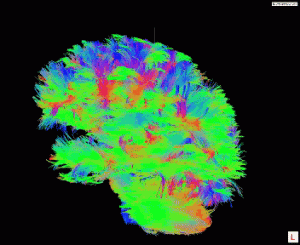 Brain Neuron Animation Courtesy Tim Ellmore