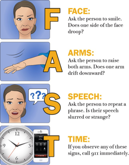 stroke symptoms face