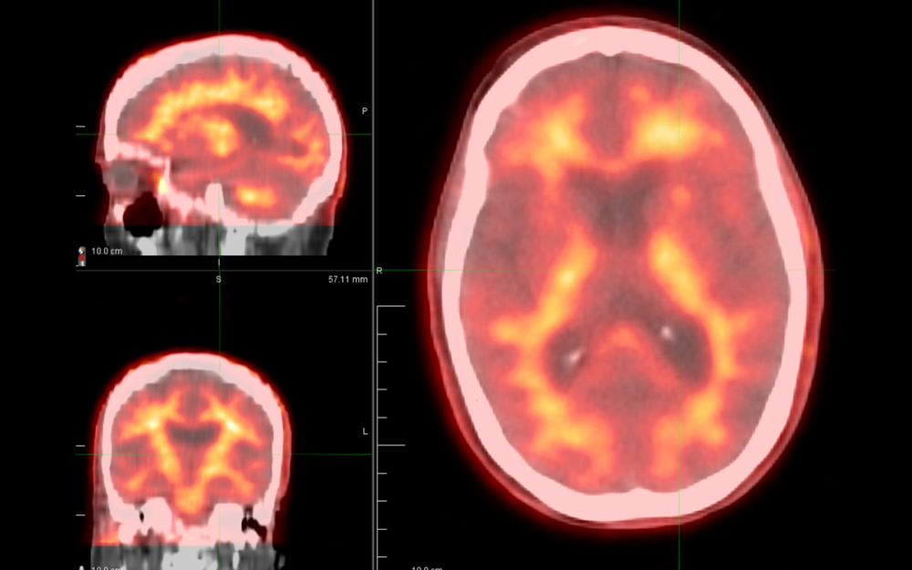 brain radiology scans