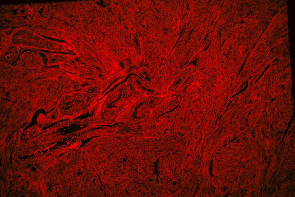 muscle and nerve biopsy image