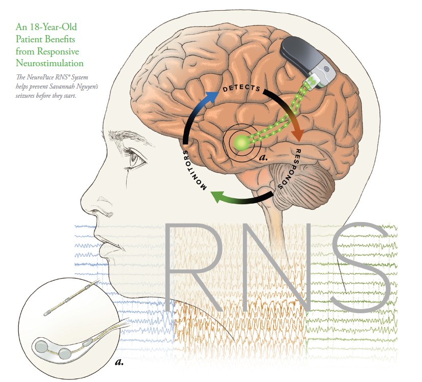 Fall 2023 Pediatric Neuroscience Journal cover