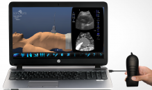 The SonoSim Ultrasound Training Solution laptop computer-based platform.