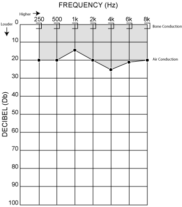 decibel vs. frequency graph