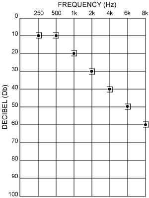 decibel vs. frequency chart