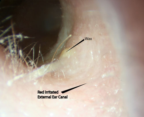 Itchy Ears | McGovern Medical School