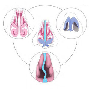 nasal diagnosis diagram