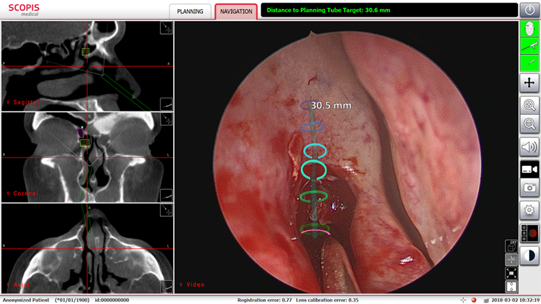 Scopis image