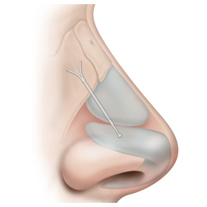 nose diagram