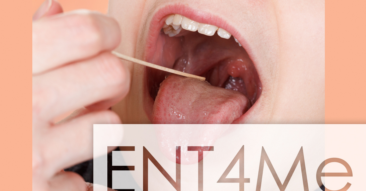 ENT4ME-tonsil banner (FB)