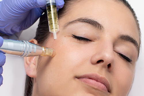 Microneedling