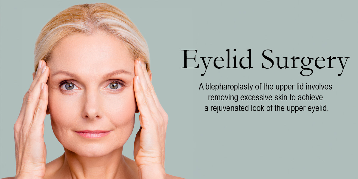 white woman with her hands on her temples next to the words Eyelid Surgery a blepharoplasty of the upper lid involves removing excessive skin to achieve a rejuvenated look of the upper eyelid.