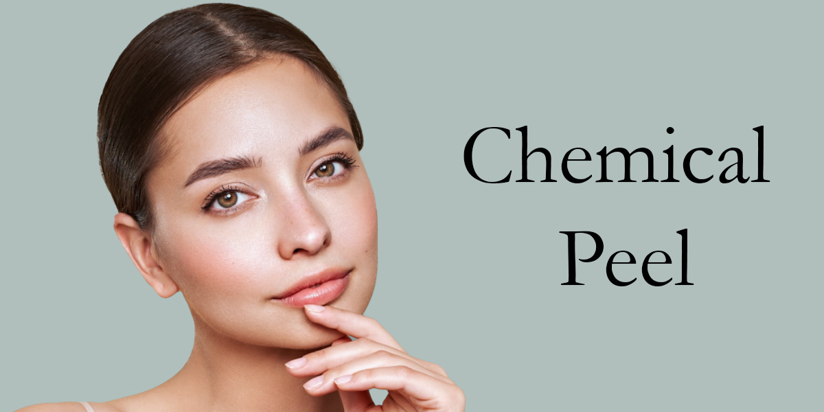 woman with brown hair touching her chin next to the words chemical peel