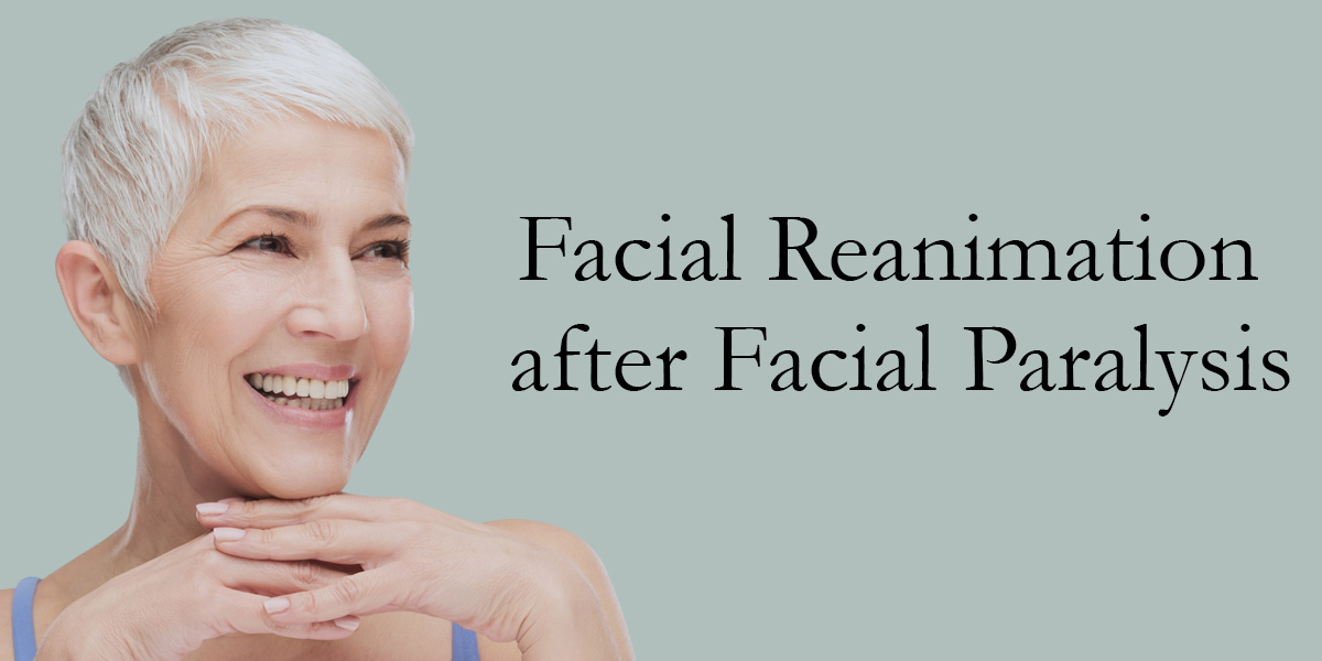 woman with short white hair resting her chin on her hands next to the words facial reanimation after facial paralysis