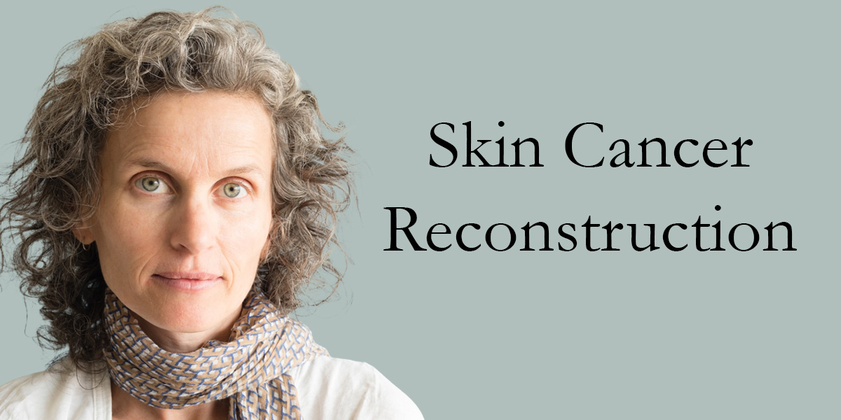 woman wearing a scarf next to the words skin cancer reconstruction