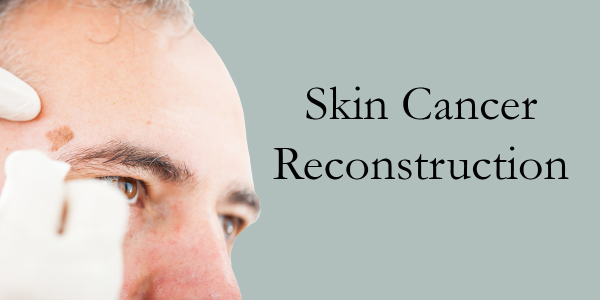 man's forehead with doctor's hand working on a spot next to the words skin cancer reconstruction