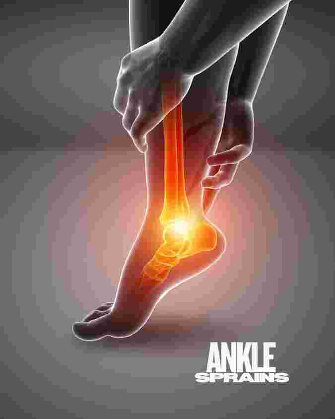 ankle sprain