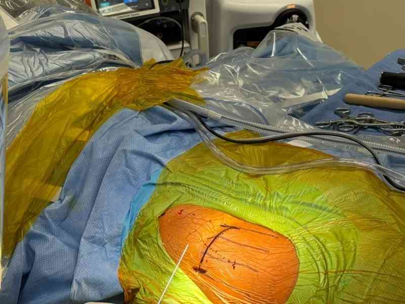 minimally invasive anterior approach with a “bikini” incision