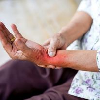 De quervain’s tenosynovitis