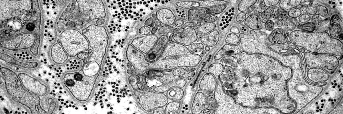 Electron microscopy of nerve and muscle