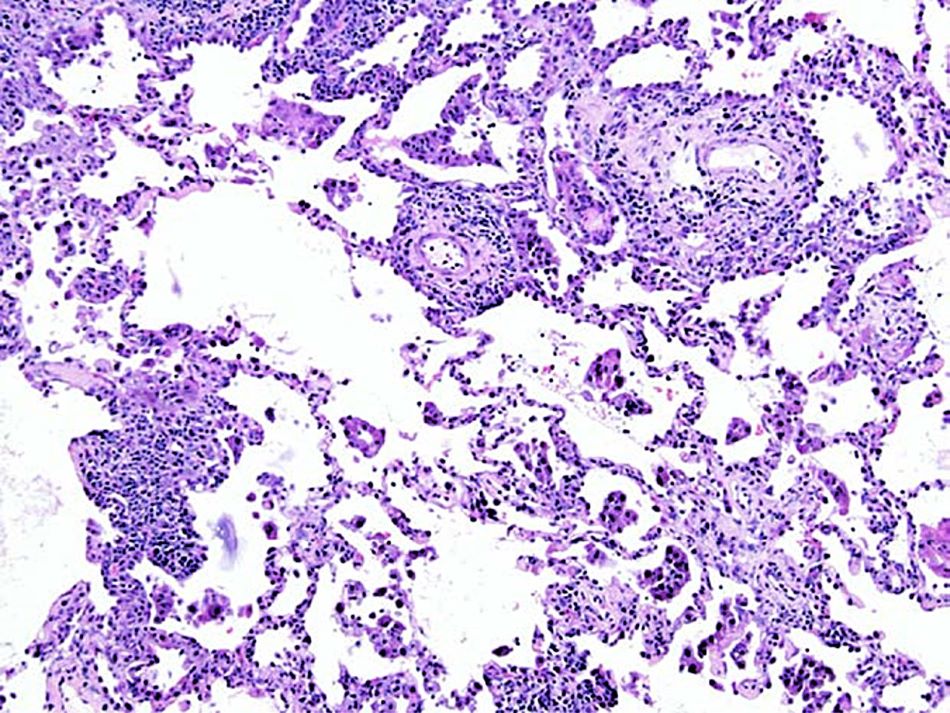 H&E of lung