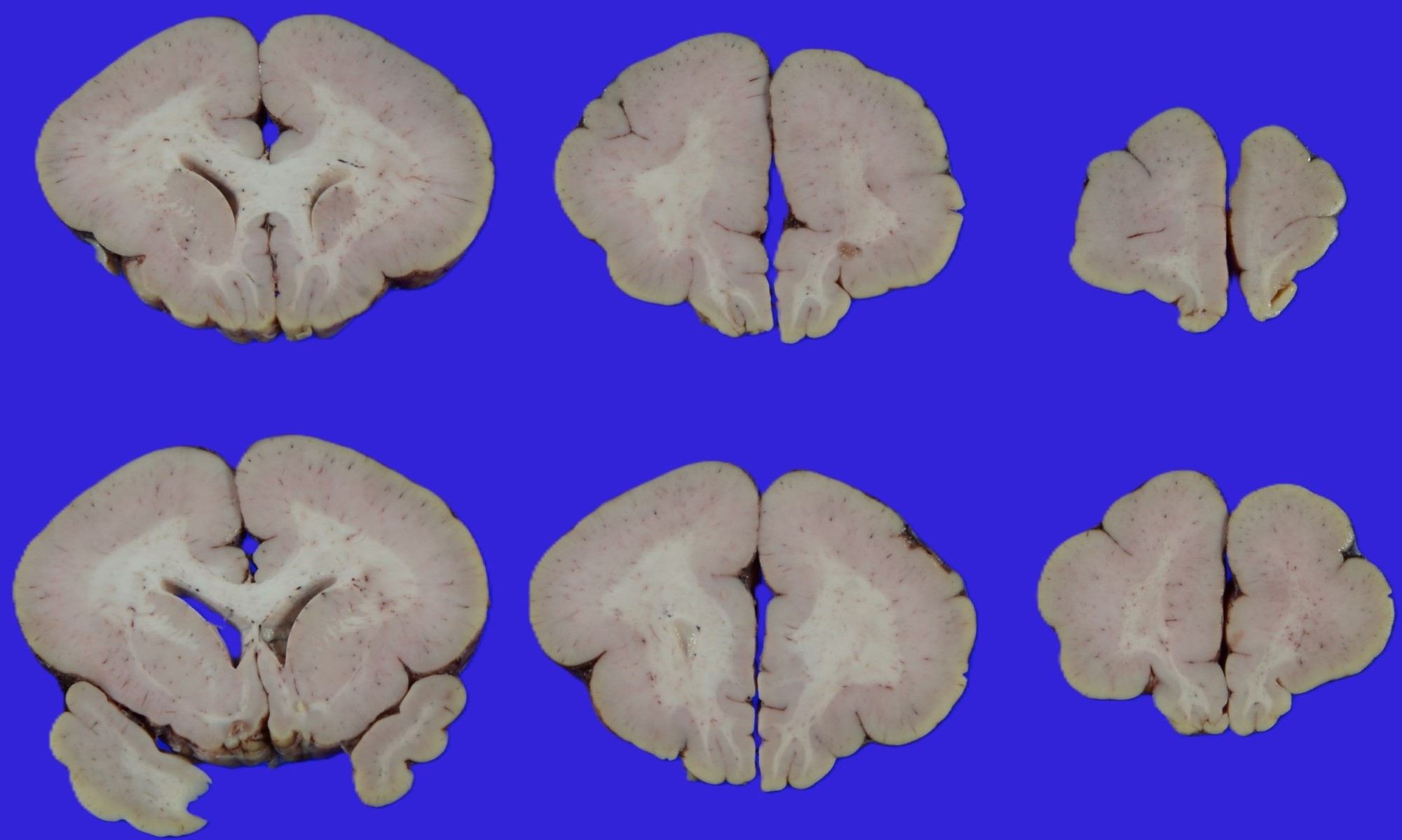 Brain cross section gross image for neuropathology fellowship