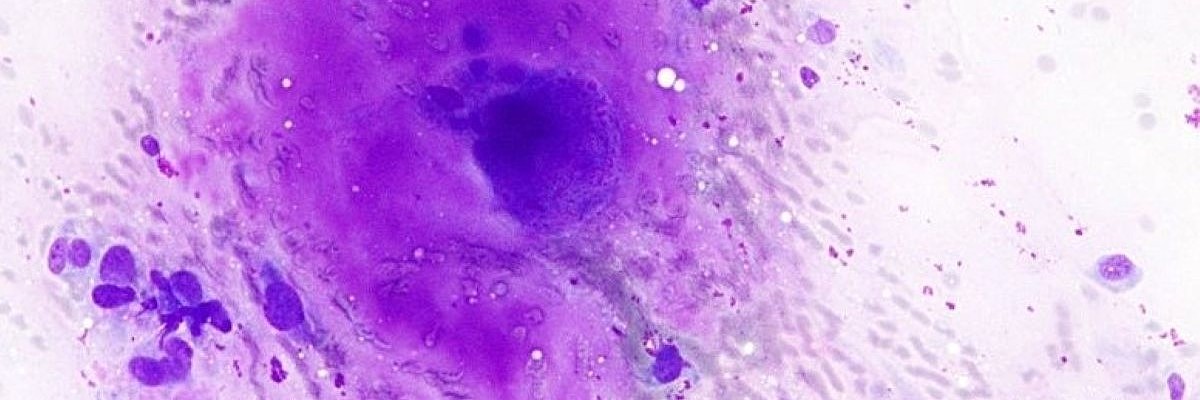 cytology smear of cells