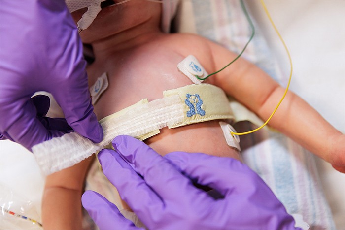 Close up of adult hands fastening EIT device on baby patient