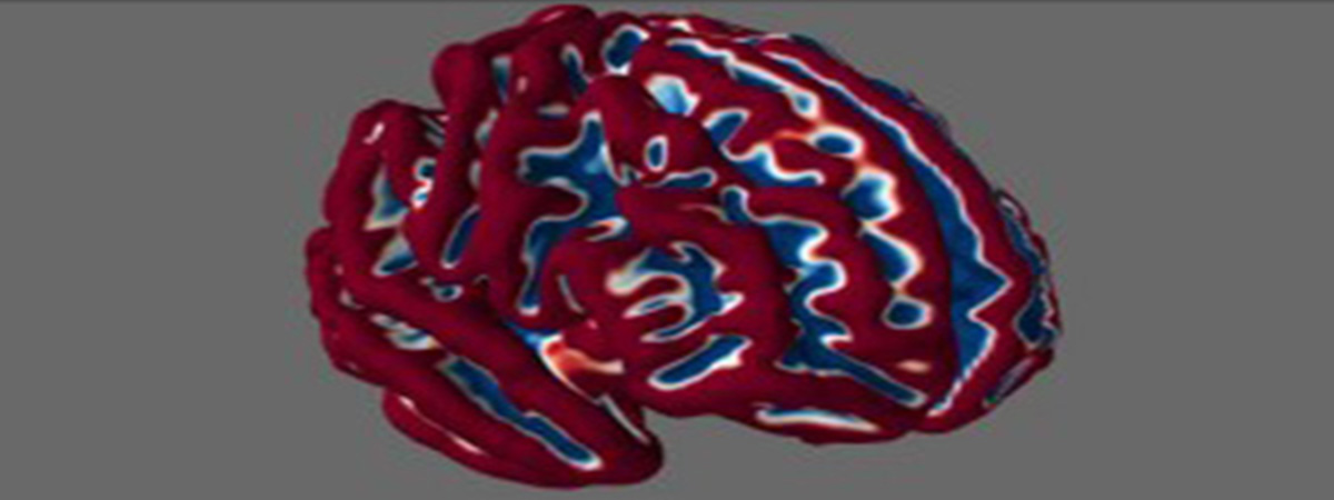 3d red and blue brain scan