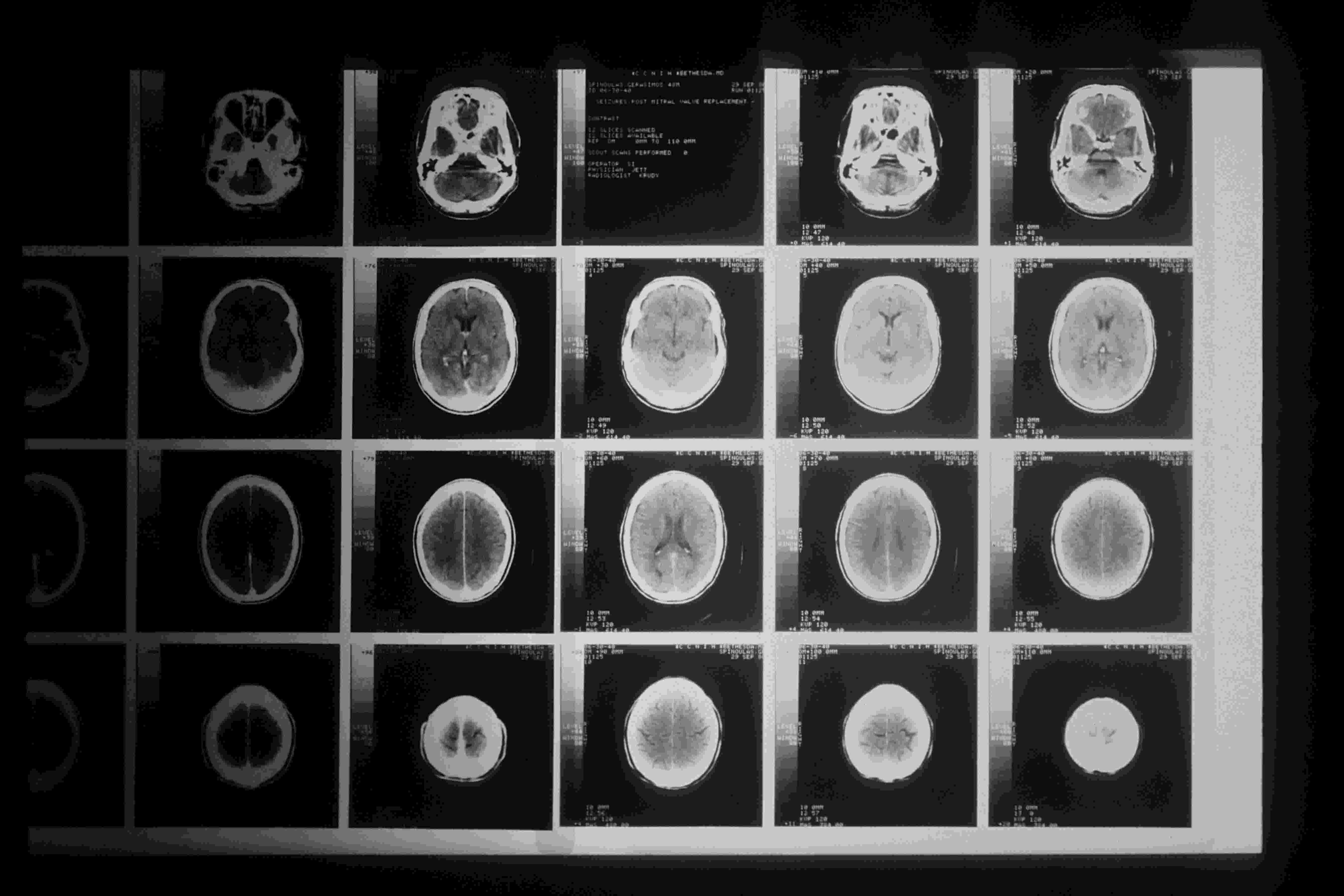 brain images